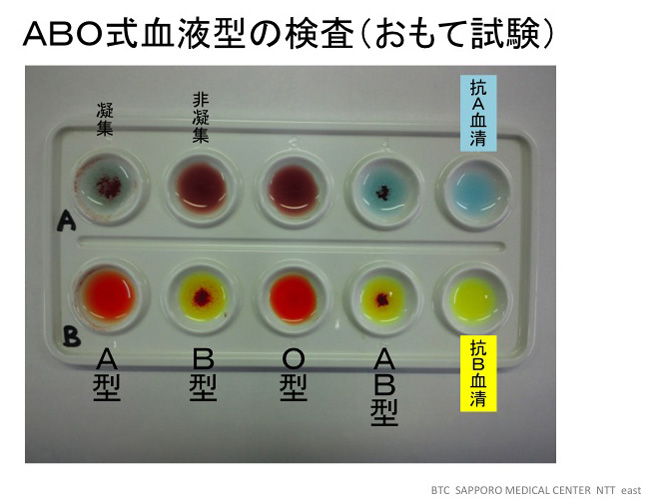 スライド法