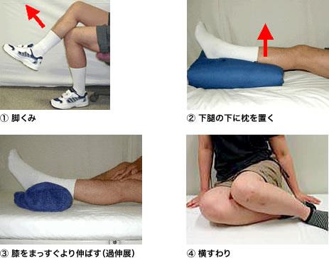 ACL再建術後の留意点悪い例