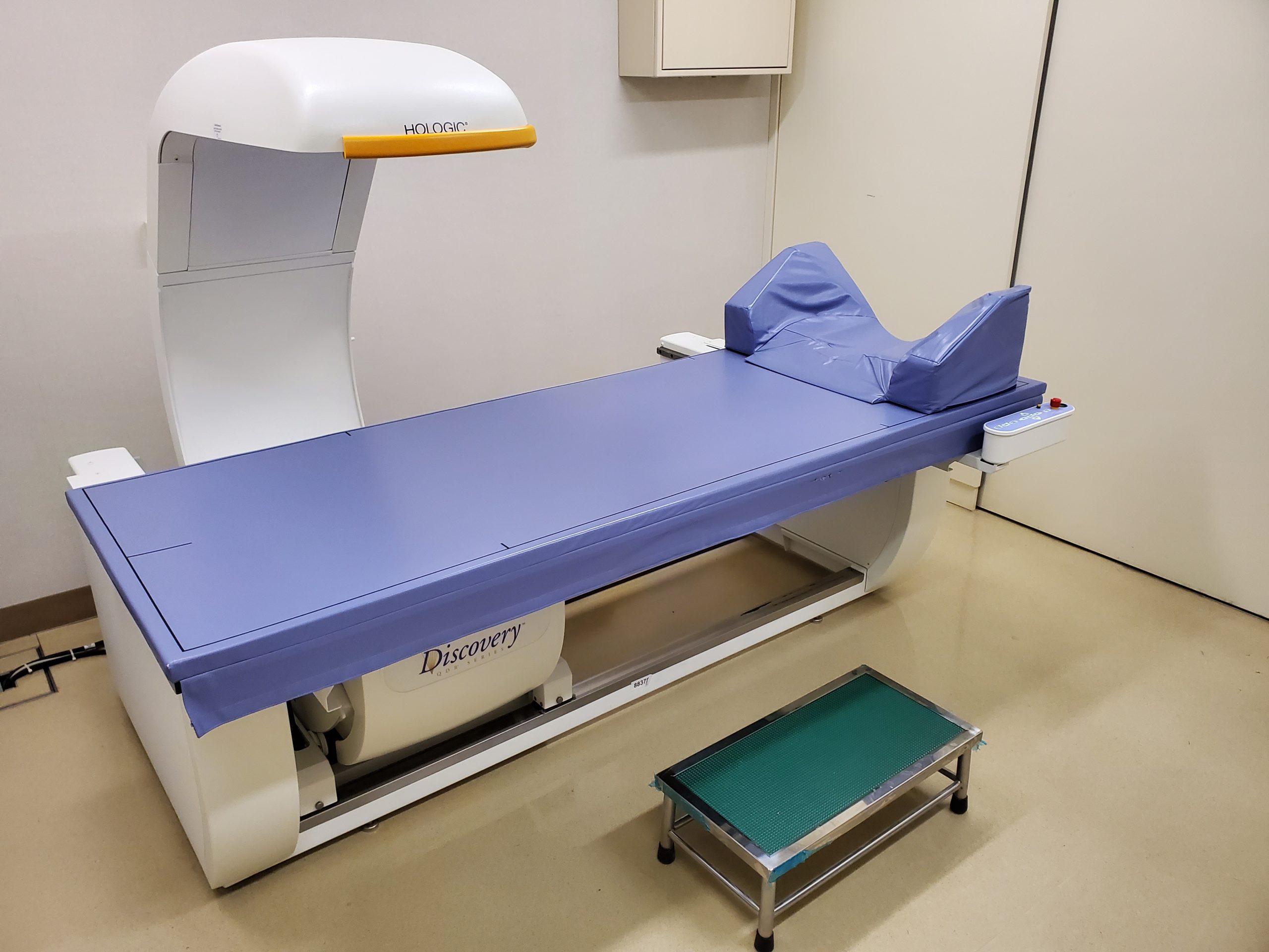 超音波装置　aplio a Verifia