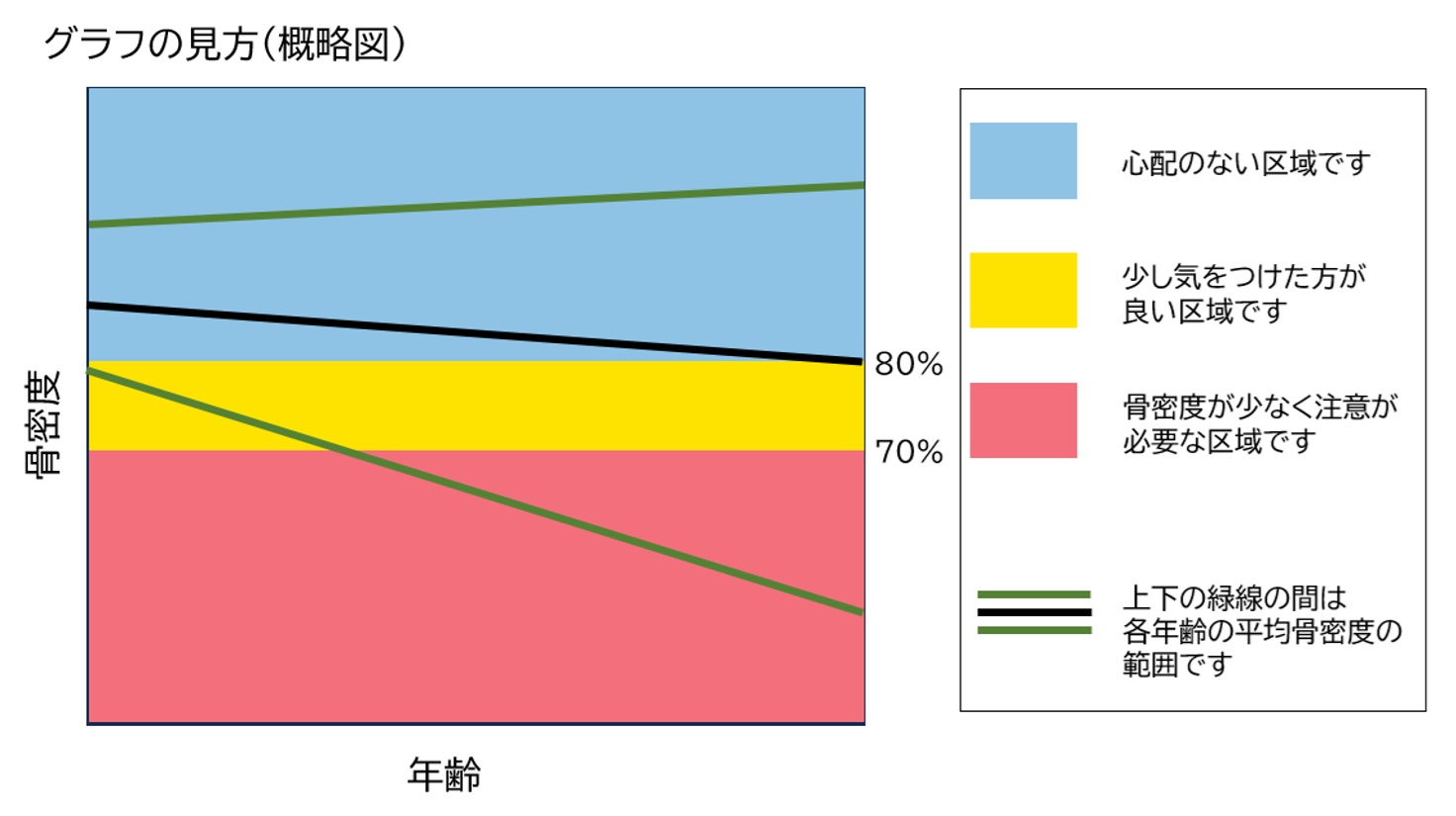超音波装置　aplio a Verifia